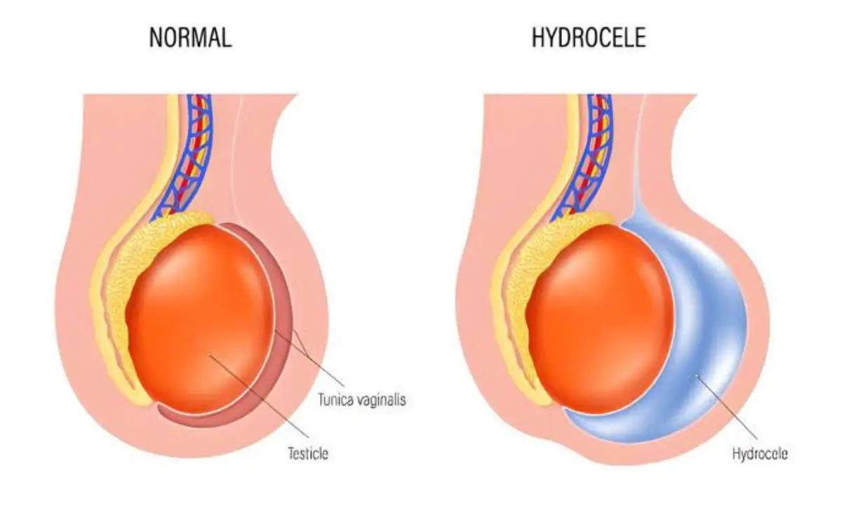 Male Urology Doctor in Delhi