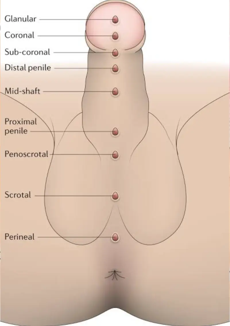 Male Urology Doctor in Delhi