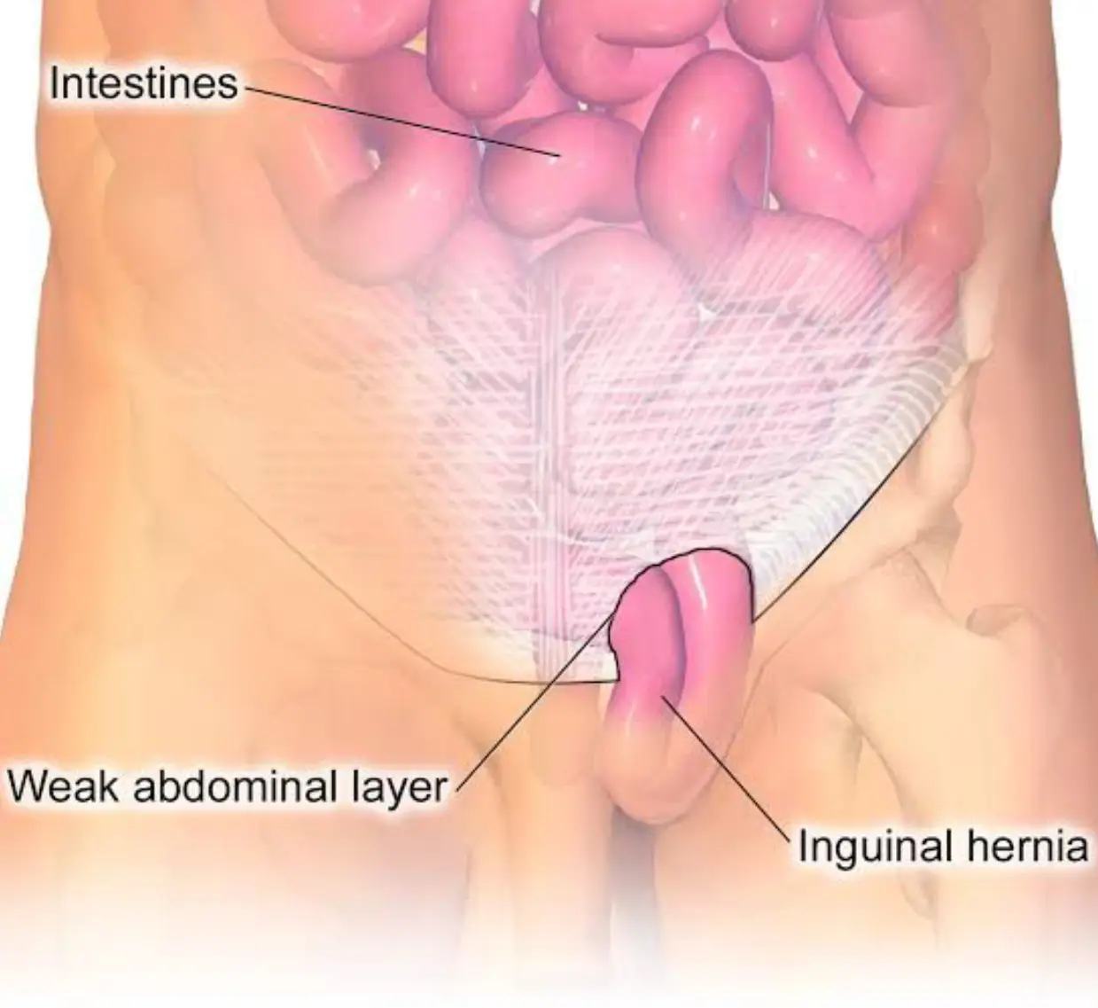 Male Urology Doctor in Delhi