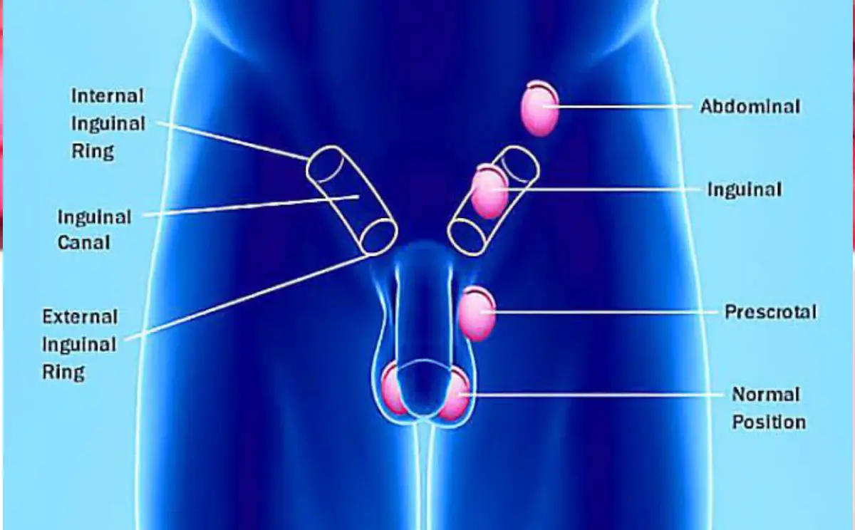 Male Urology Doctor in Delhi