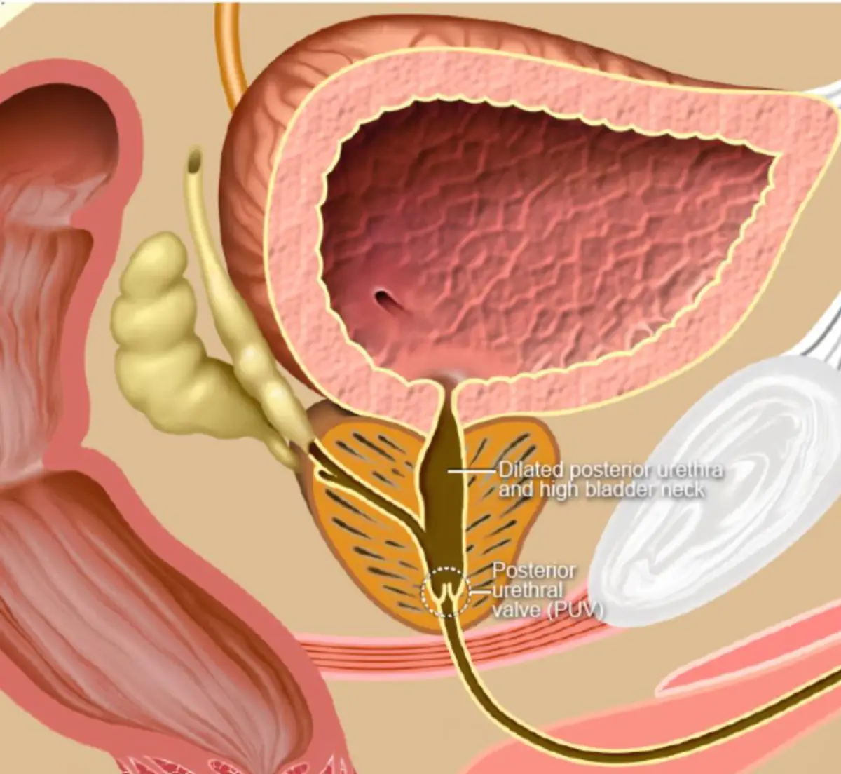 Male Urology Doctor in Delhi