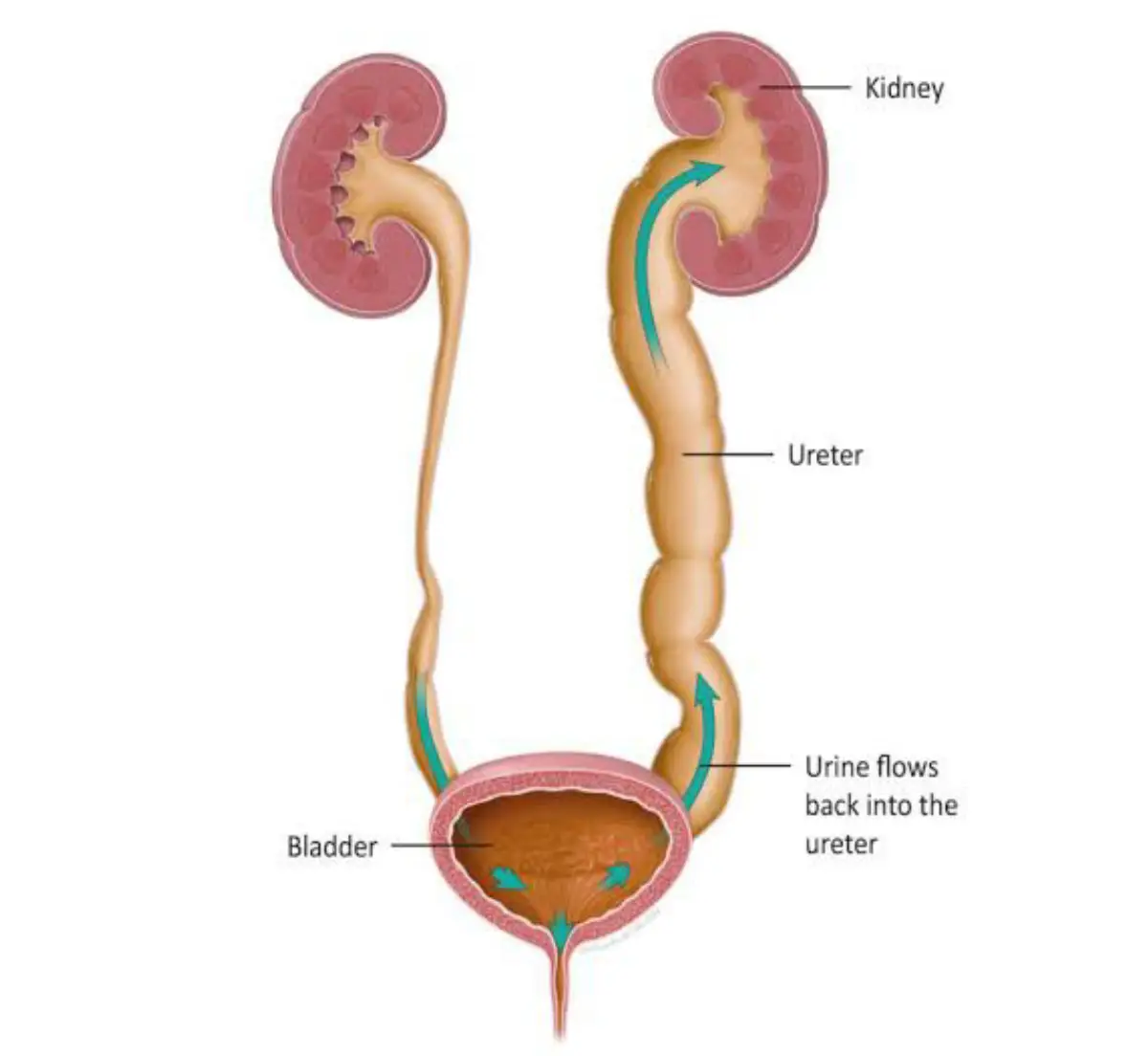 Male Urology Doctor in Delhi