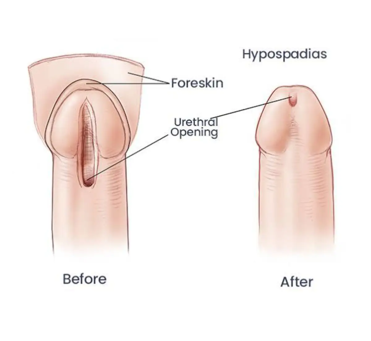 Male Urology Doctor in Delhi