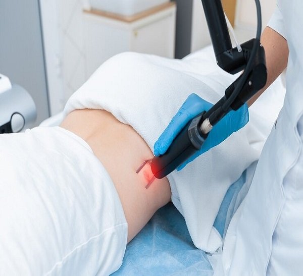 Laser Treatment For Kidney Stones
