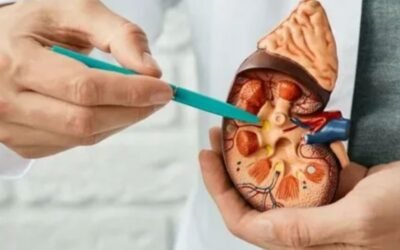 Benefits of Choosing Laser Treatment for Kidney Stones Over Traditional Methods