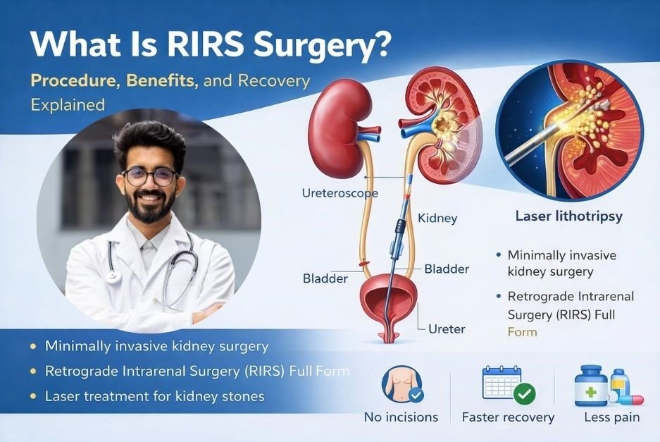 What is RIRS Surgery? Procedure, Benefits, and Recovery Explained