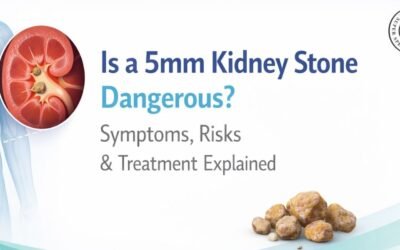 Is a 5mm Kidney Stone Dangerous? Symptoms, Risks, and Treatment Explained