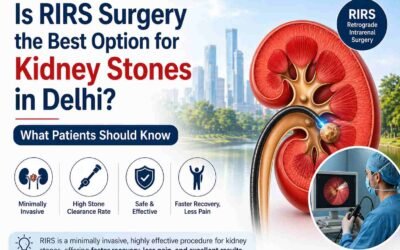 Is RIRS Surgery the Best Option for Kidney Stones in Delhi? What Patients Should Know