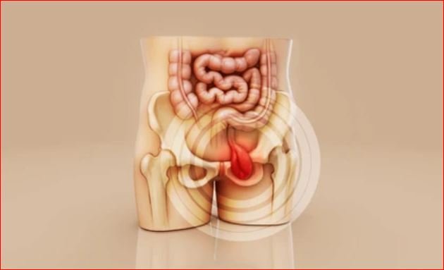 Hernia Surgery in Paschim Vihar