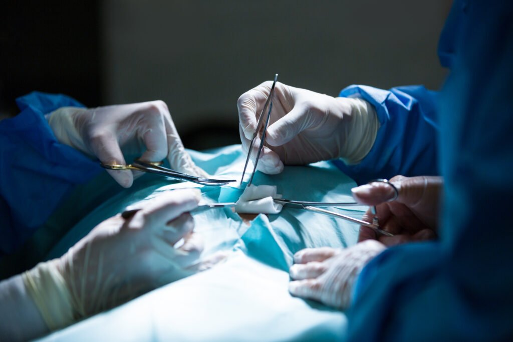 Best Piles Surgery in West Delhi | HOK Super Speciality Hospital